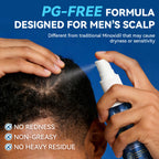 5% Minoxidil Solution